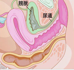 感染发病机理是是什么
